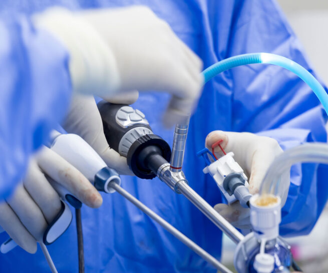 laparoskopische-chirurgie